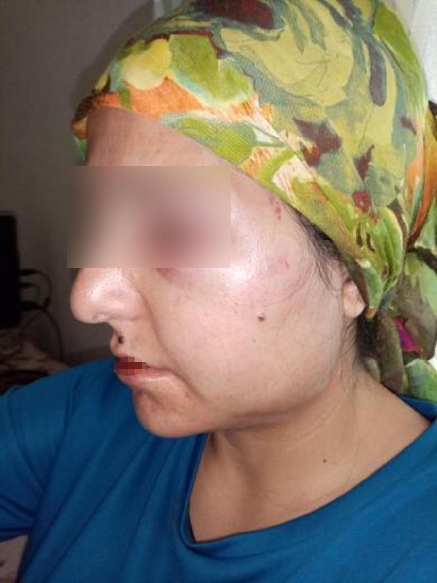 Hatay'da eşinden şiddet gören kadın: Artık dayanamıyorum