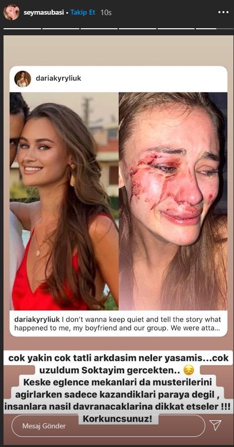 Top model Daria Kyryliuk Çeşme'de saldırıya uğradı