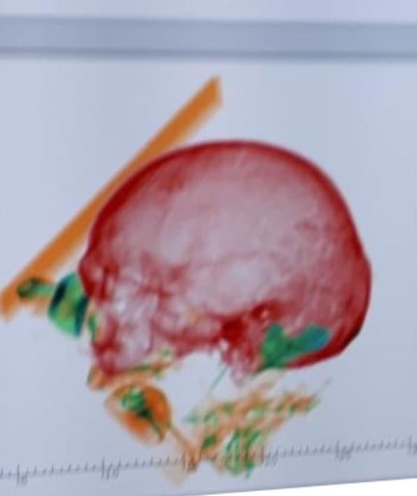 Ermeni kadın kocasının kemiğini uçakla taşıdı