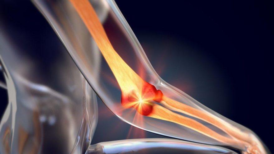 Cam kemik hastalığı nedir