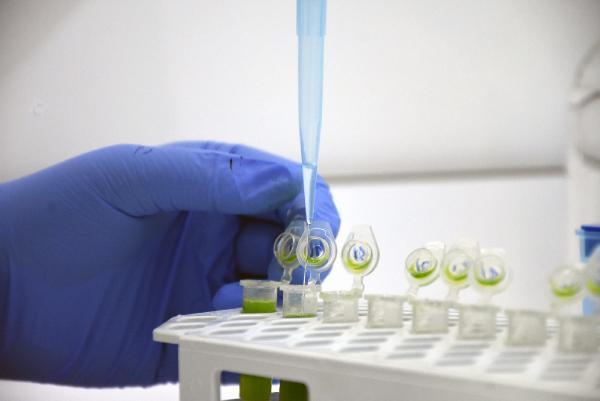 Niğde’de hastalıklara dayanıklı yerli ve milli patates