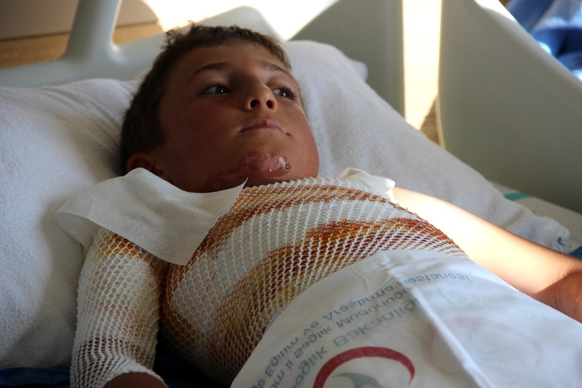 Ardahan’da gömleğindeki ip yerine kendini yaktı