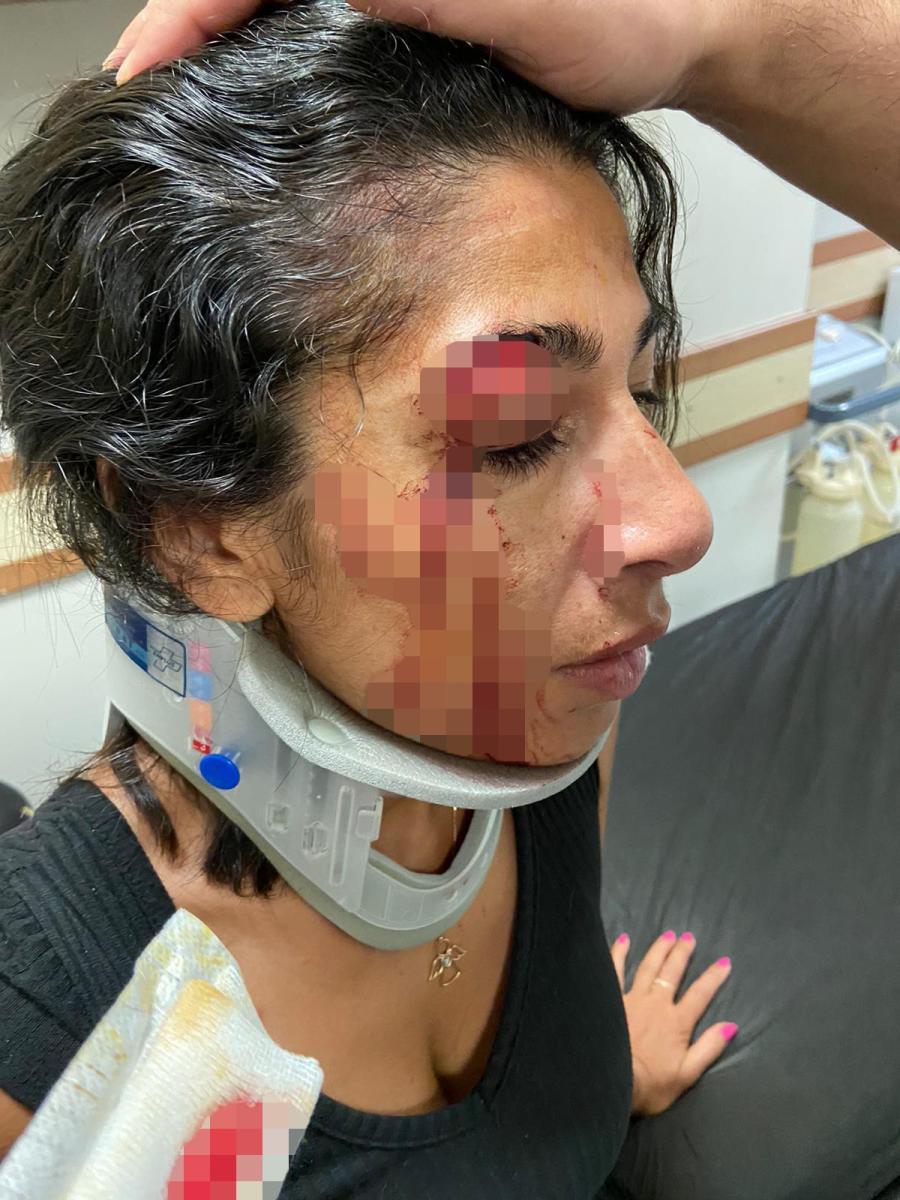 Bodrum'da kadınların 'niye bakıyorsunuz' kavgası