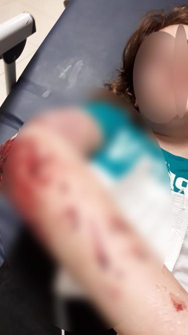 Adana’da ağabeyinden korkup ikinci kattan atladı