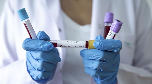 AB, korona aşısı için İngiliz şirketle anlaştı