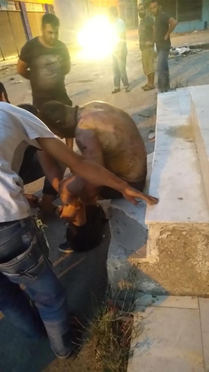 İzmir'de tinerciyi tiner dökerek yaktılar