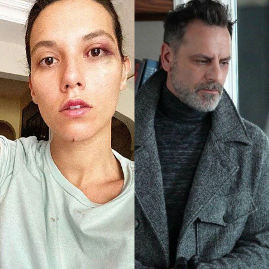 Halit Ergenç, Ozan Güven'i savundu