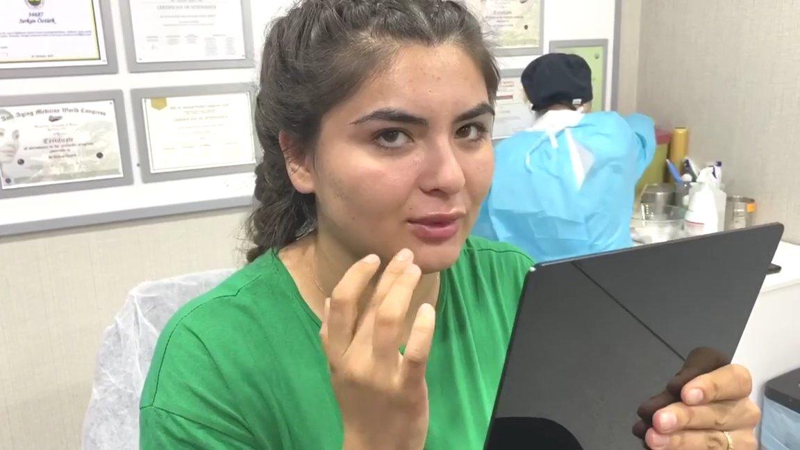 Hanife Gürdal, dudaklarını büyüttü