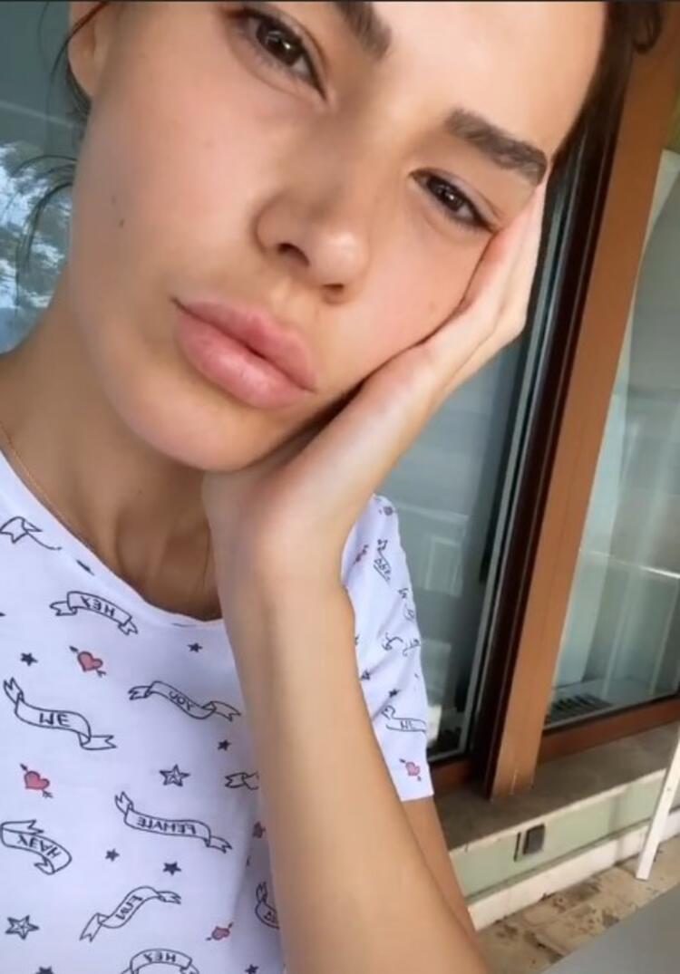 Hatice Şendil'in dudakları büyüdü