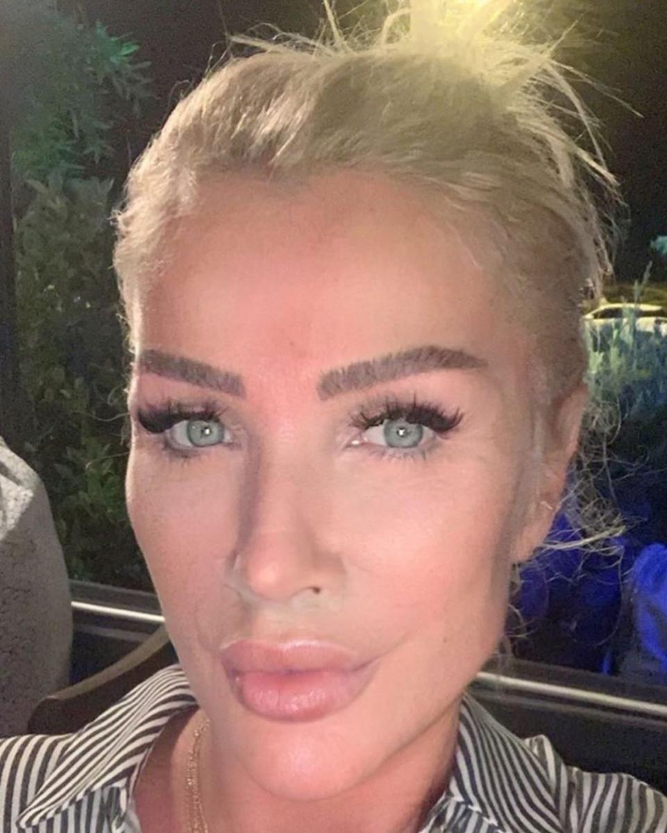 Seda Sayan, yine estetik yaptırdı