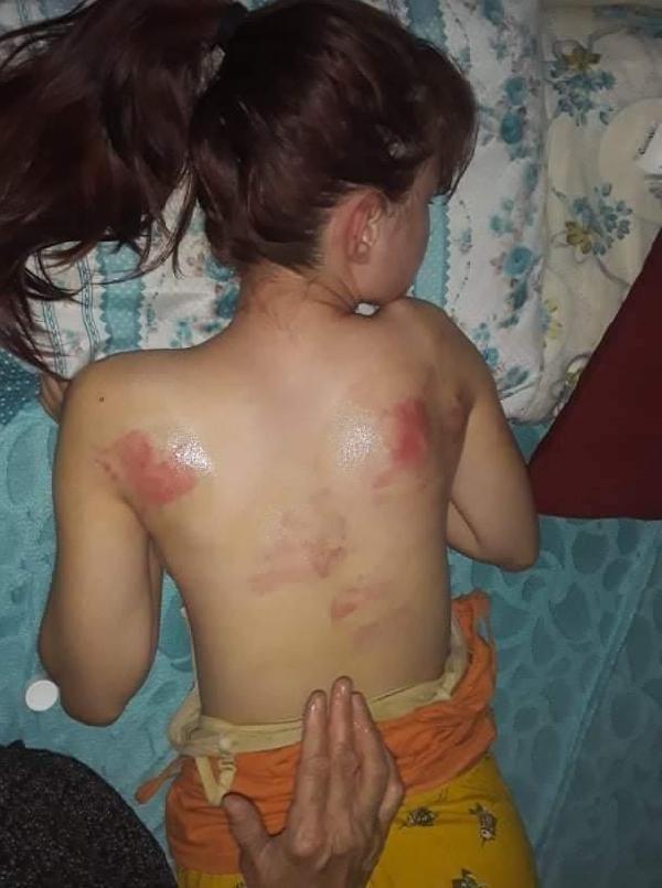 Tekirdağ’da cep telefonu şifresini söylemeyen kızını dövdü