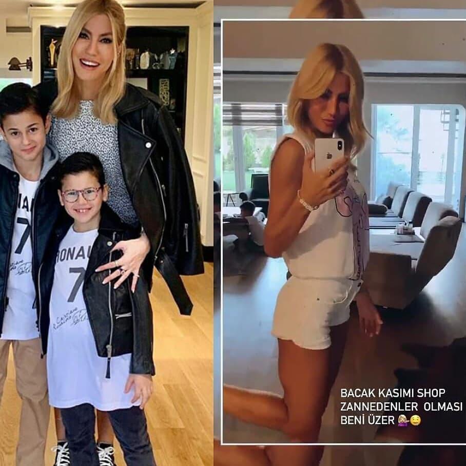 Çağla Şıkel: Bacakları photoshop zannetmeniz beni üzer