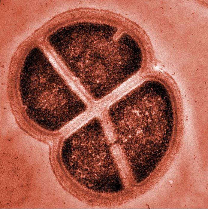 Deinococcus