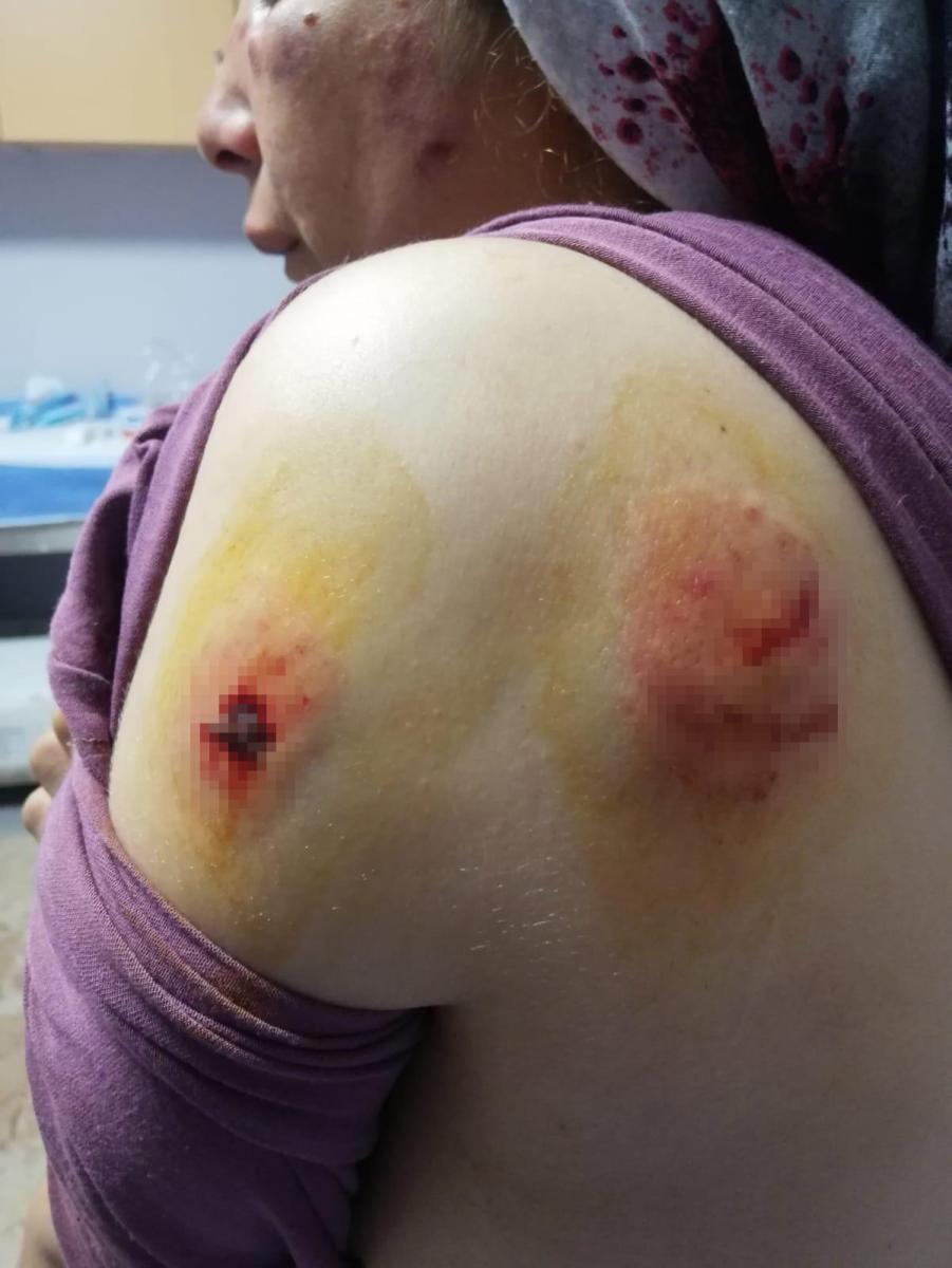 Gaziantep’te cani koca eşini öldüresiye darbetti