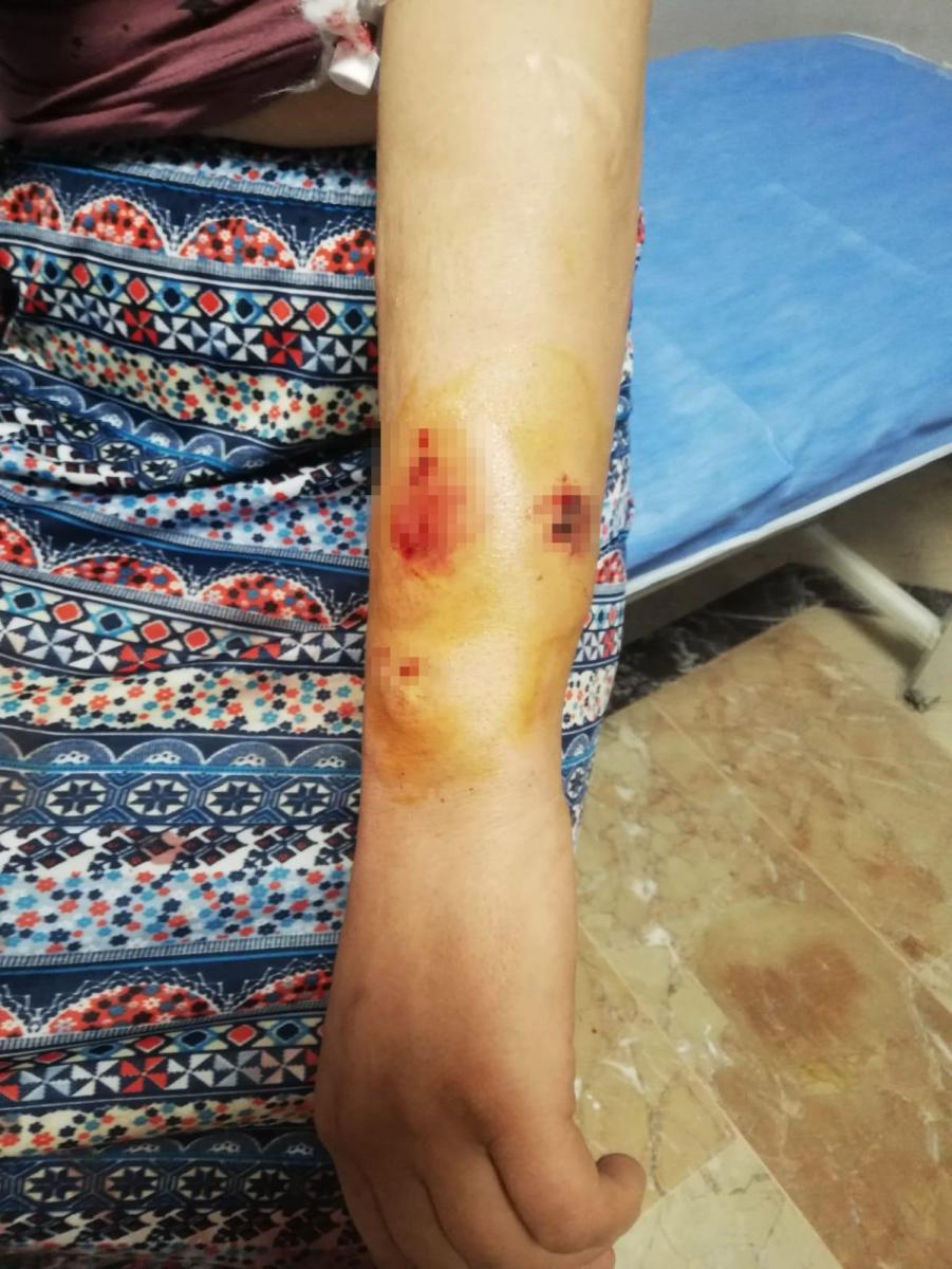 Gaziantep’te cani koca eşini öldüresiye darbetti