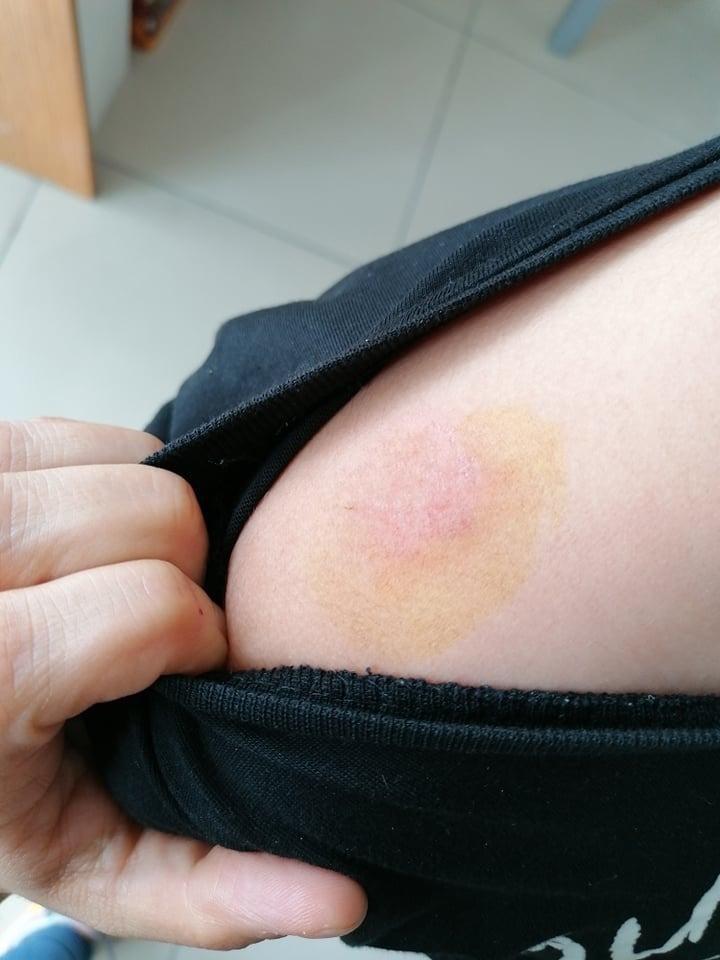 Eyüpsultan'da çocuğa köpek saldırısı