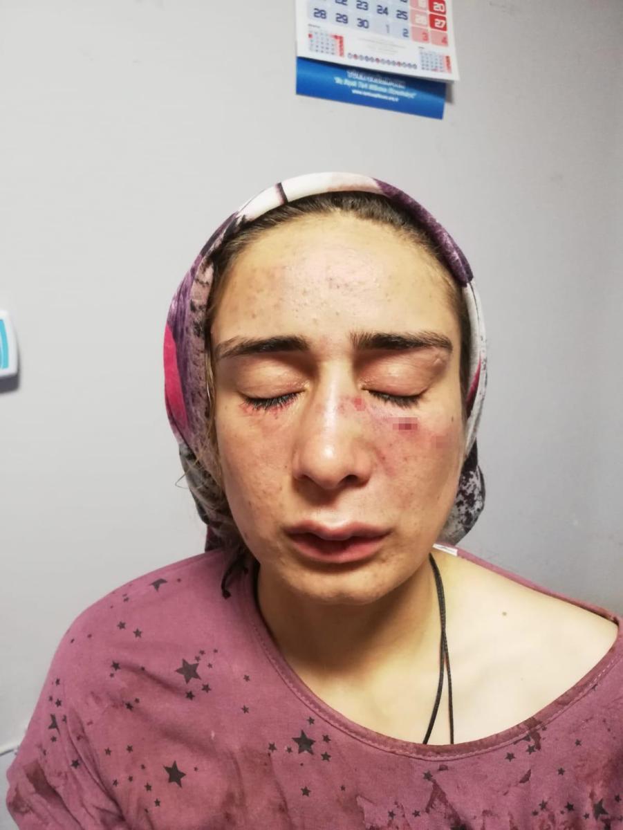 Gaziantep’te cani koca eşini öldüresiye darbetti