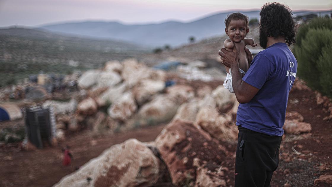 Kolları ve bacakları olmayan Muhammed bebek yardım bekliyor