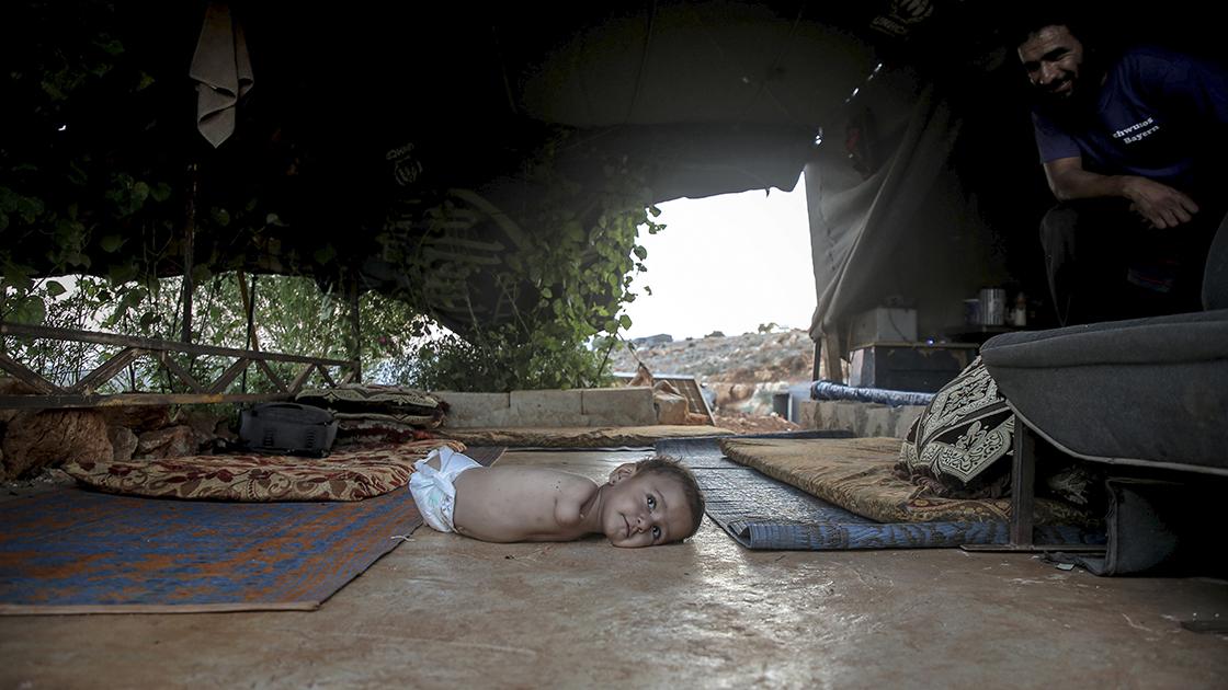 Kolları ve bacakları olmayan Muhammed bebek yardım bekliyor