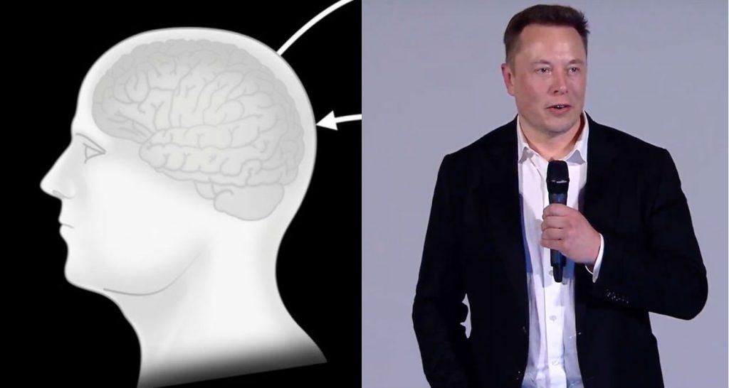 elon musk neuralink