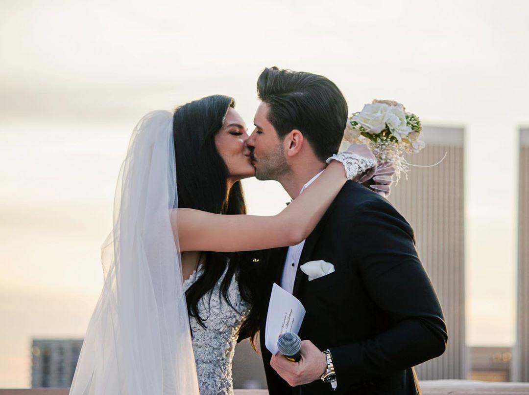 Almeda Abazi dekoltesini sansürledi