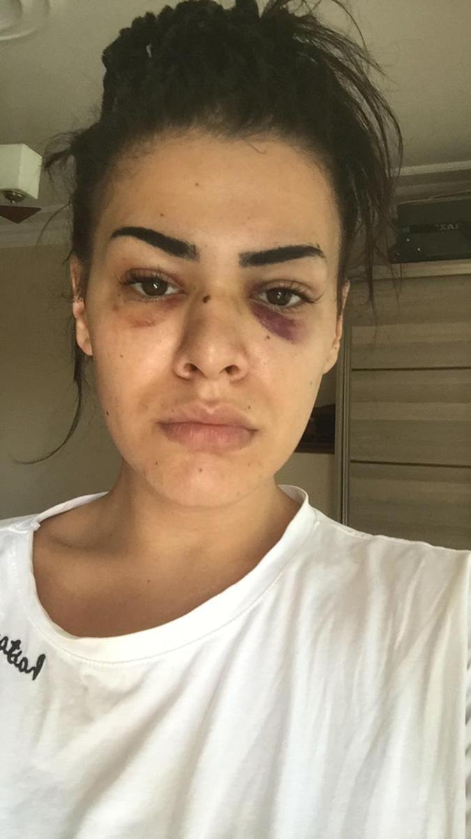 İstanbul'da tanımadığı iki kişi tarafından saldırıya uğradı