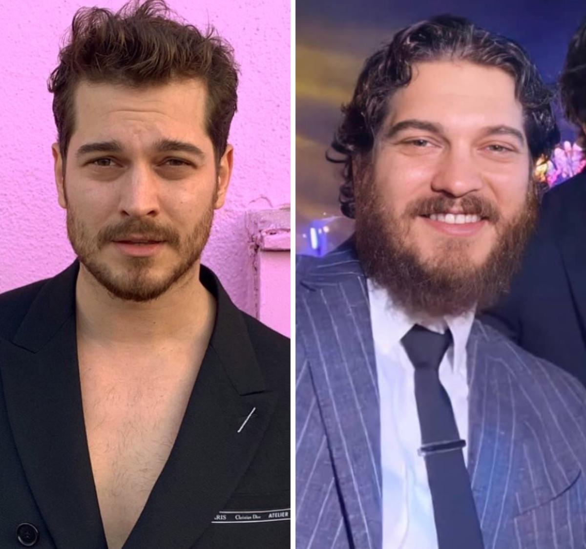 Çağatay Ulusoy'un yeni hali görenleri şaşırttı