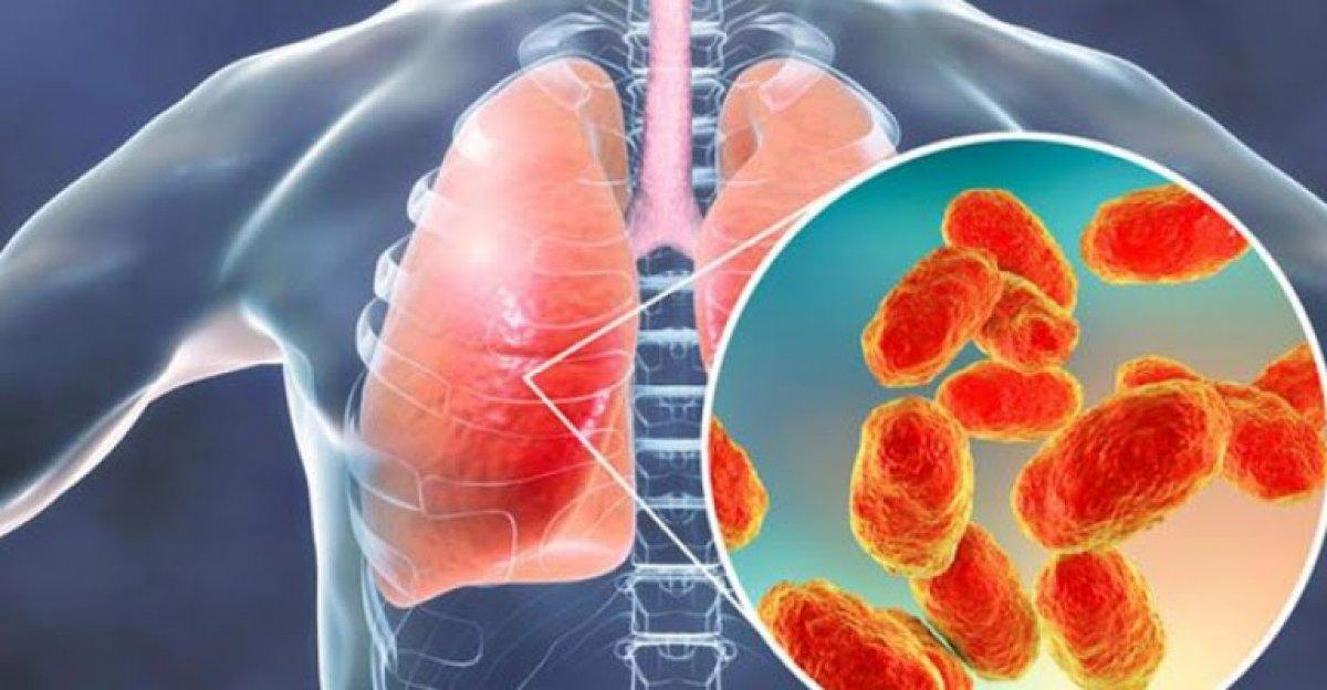 Pnömoni ne demek? Pnömonili (Zatüre) hasta ne demek?