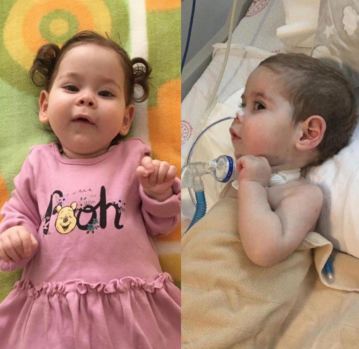 SMA hastası Zeynep bebek yardım bekliyor