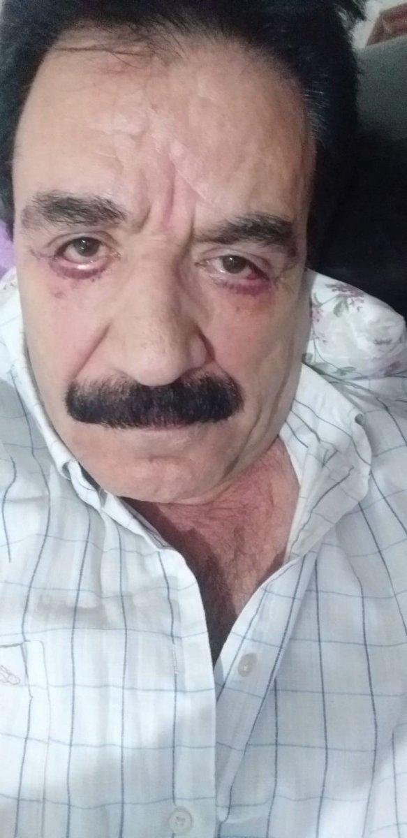 İstanbul’da ‘göz doktoru hatalı estetik yaptı’ iddiası