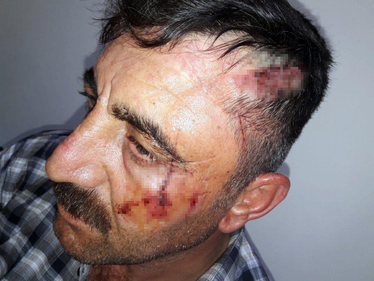 Afyonkarahisar'da annesini ziyarete gitti, akrabaları darbetti