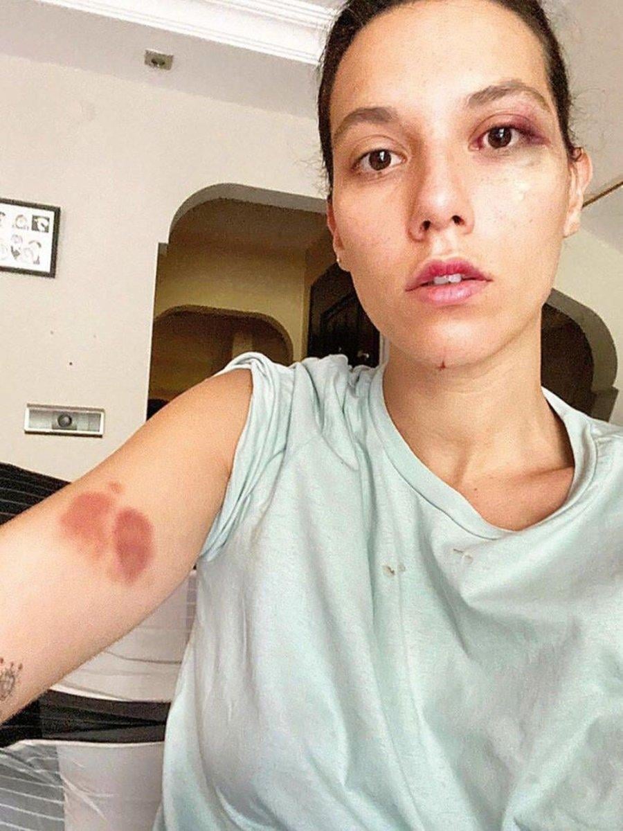 Deniz Bulutsuz'a 1 yıl hapis istemi