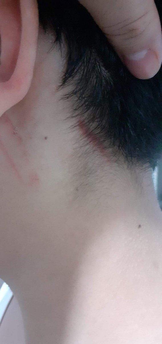 Tekirdağ'da parktaki çocuğun darbedilme anları