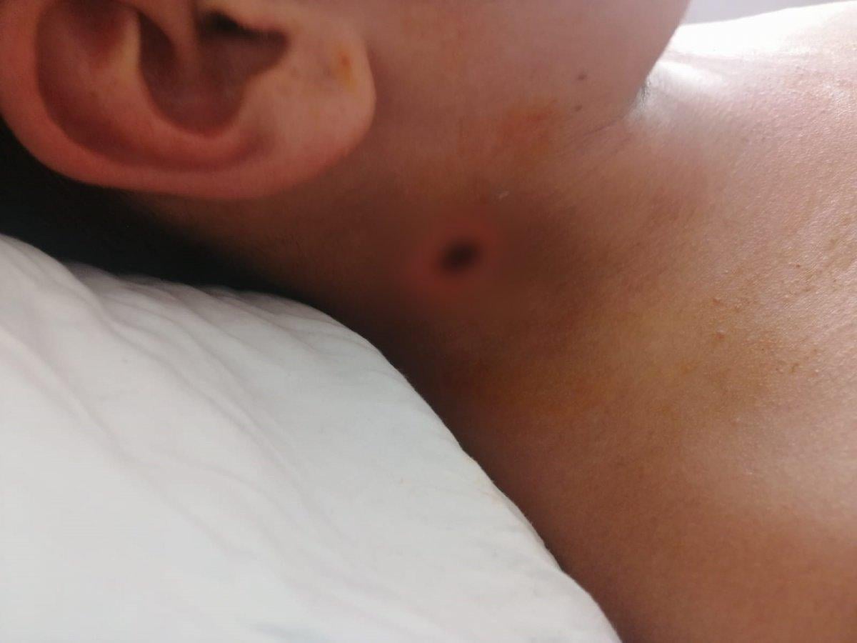 Bursa’da yeğeninin vurduğu Eren’i hastanede ziyaret eden gence satırla saldırdı