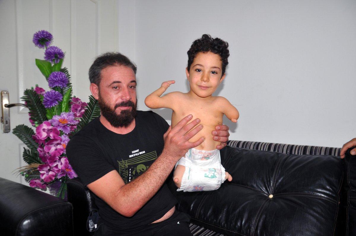 Hatay'da 2 bacağı ve 1 kolu olmayan minik Mustafa, protez istiyor