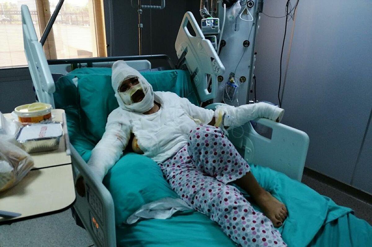 İstanbul'da yüzüne kızgın yağ attığı erkek arkadaşı ceza aldı, kadının tepkisi pes dedirtti