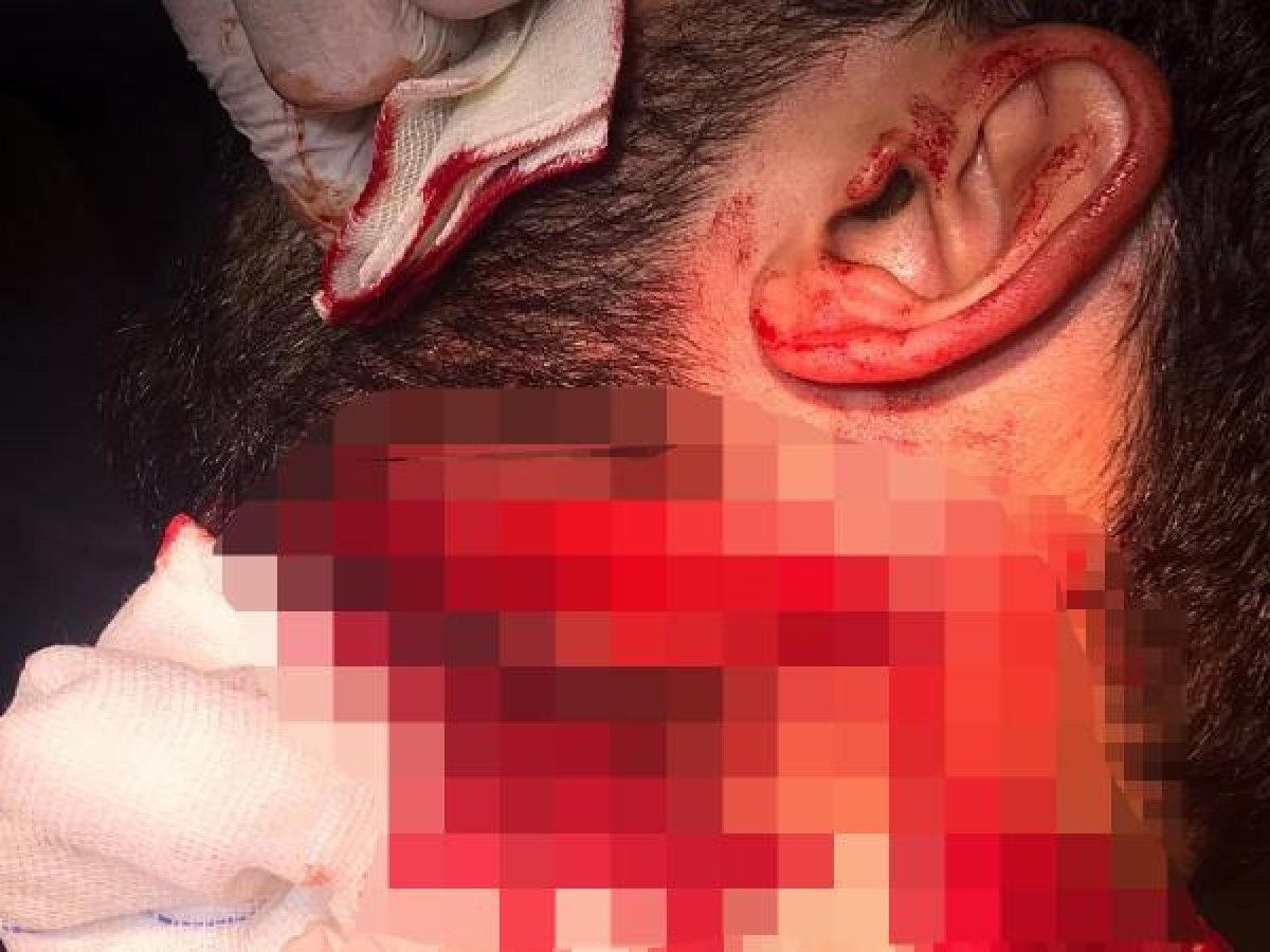 İzmir'de asistan doktor Kadir Songür'ü yaralayan sanığa 20 yıl hapis