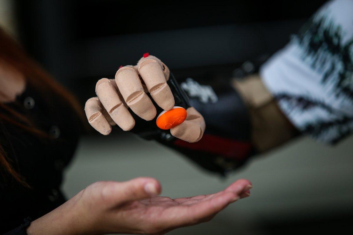 Kollarını kaybeden Kolombiyalı genç, üç boyutlu protezlerine kavuştu