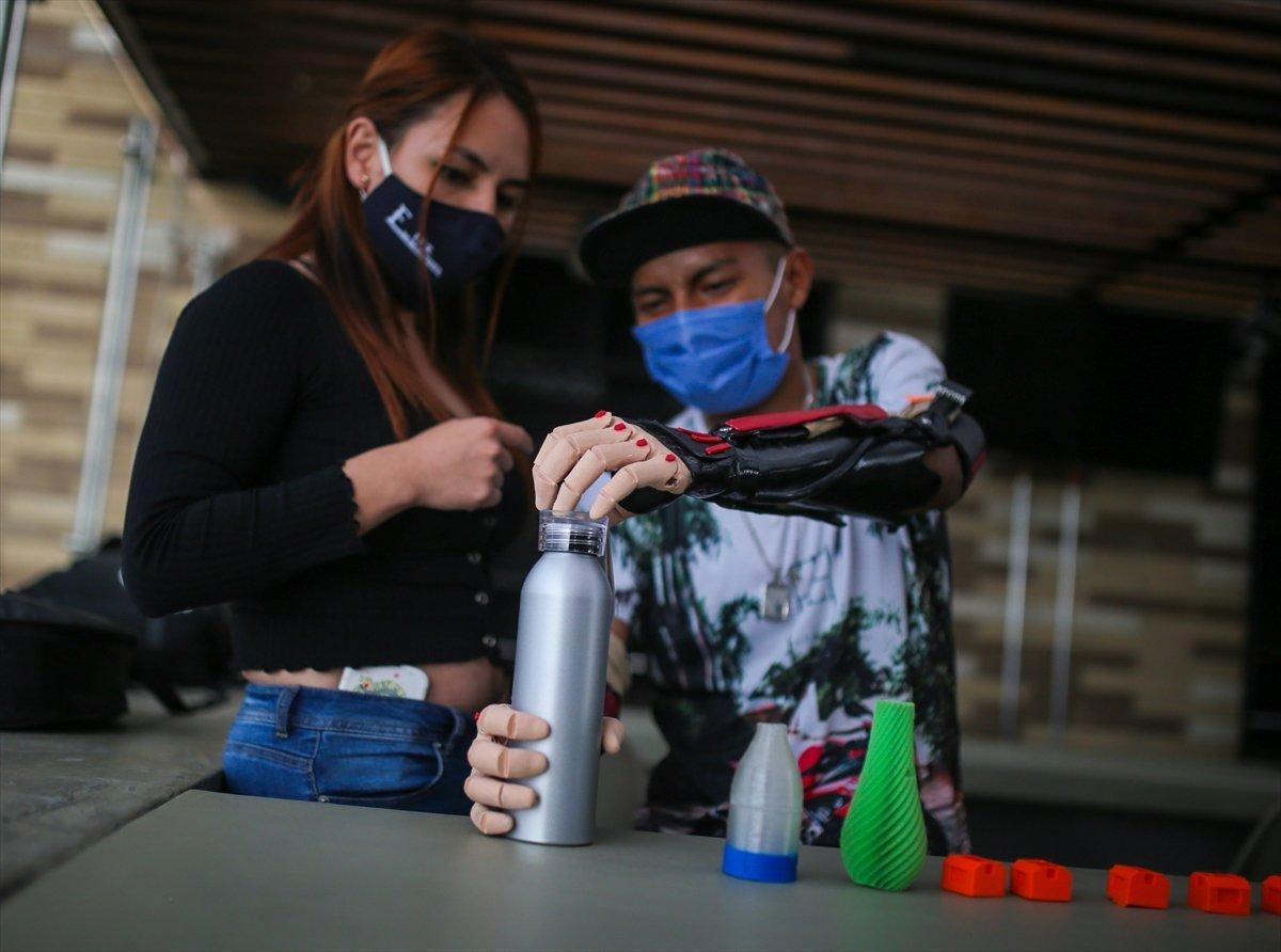 Kollarını kaybeden Kolombiyalı genç, üç boyutlu protezlerine kavuştu