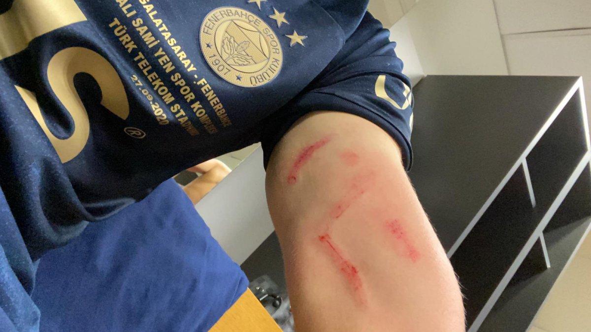 Fenerbahçe'den hakeme Luyindama tepkisi