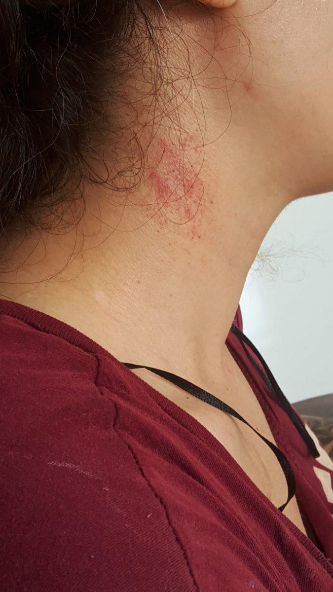 Mersin'de eşinden şiddet gören engelli kadın yardım bekliyor