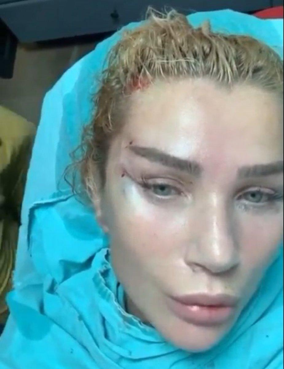 Seda Sayan, yüzüne estetik yaptırdı