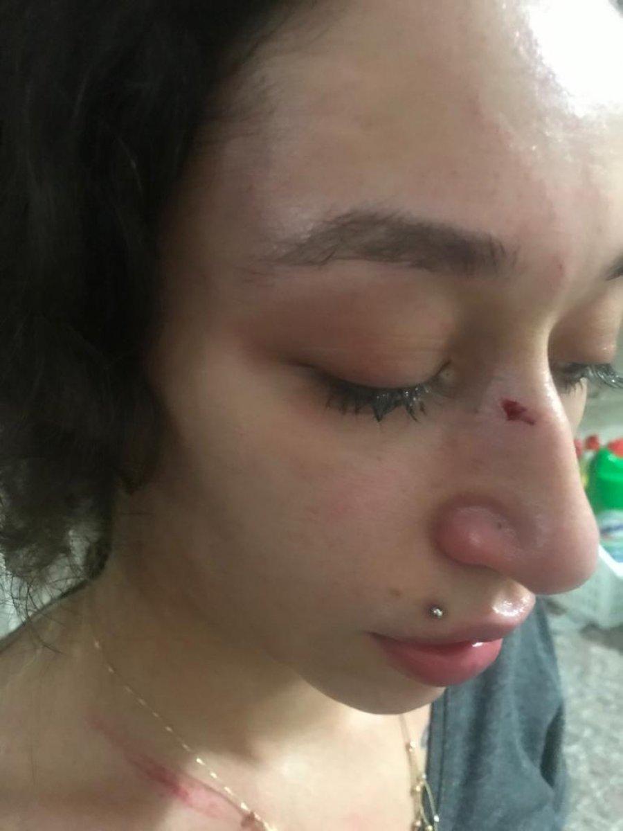 Mersin'de eşinden şiddet gören engelli kadın yardım bekliyor