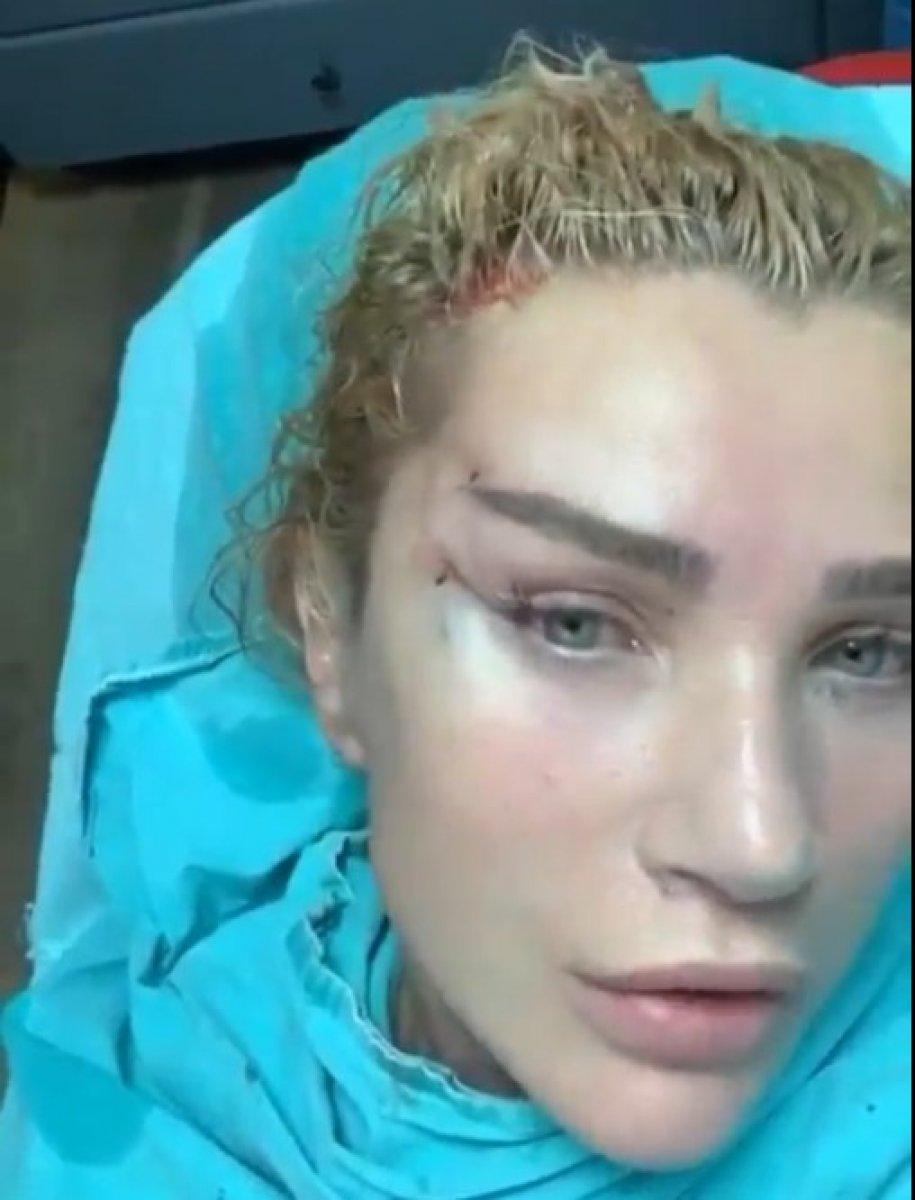 Seda Sayan, yüzüne estetik yaptırdı