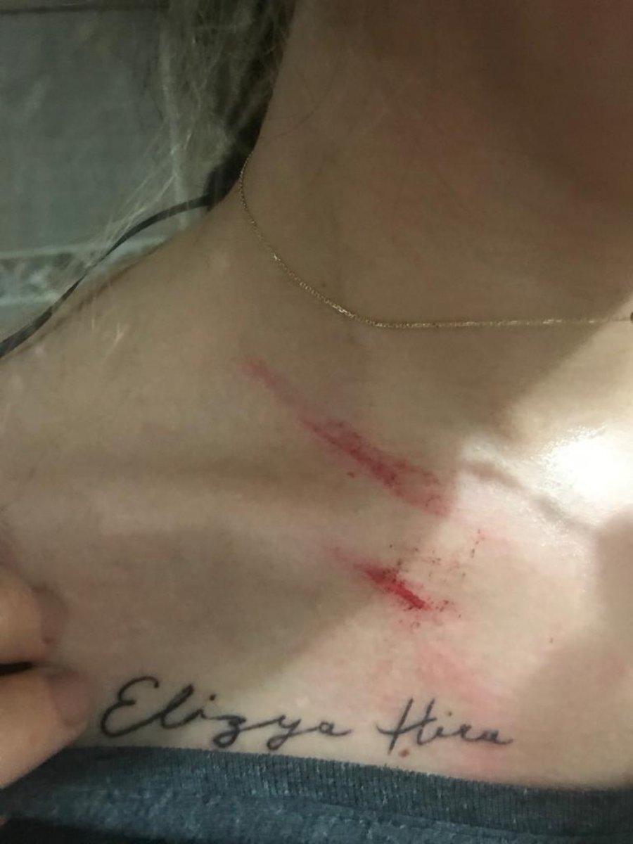 Mersin'de eşinden şiddet gören engelli kadın yardım bekliyor