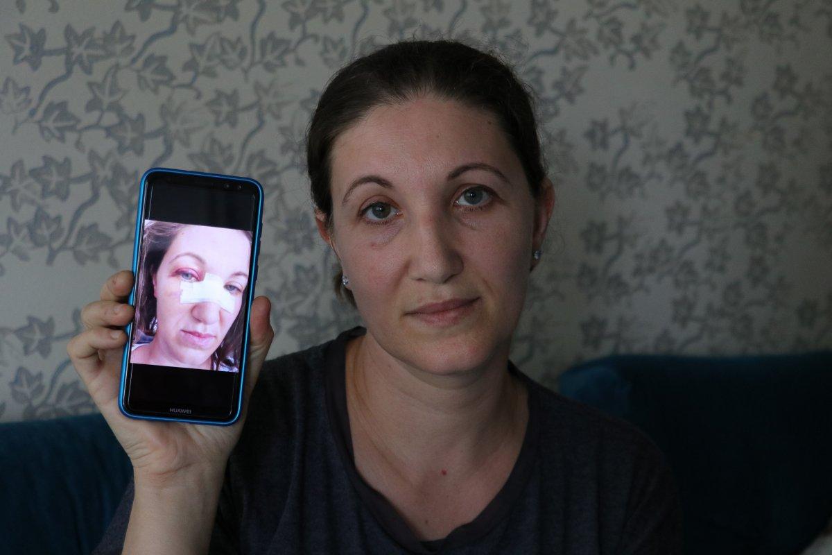 Adana’da gelinliği kirletip, kadın çalışanı darbettiler