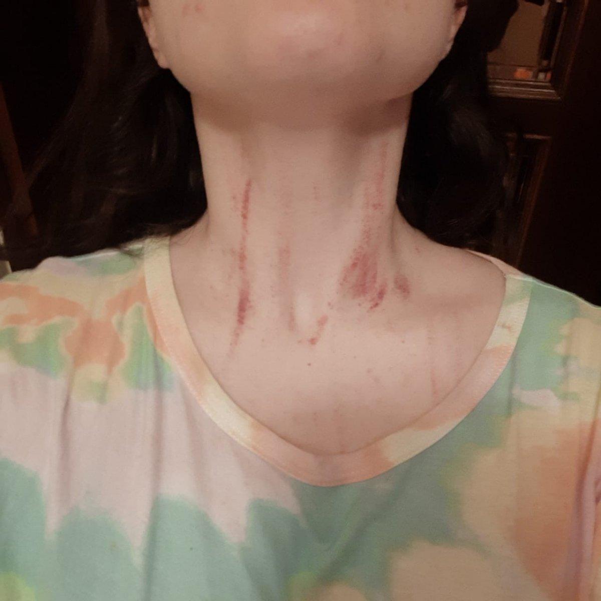 Beykoz’da komşular arasında çıkan kavganın yeni görüntüleri