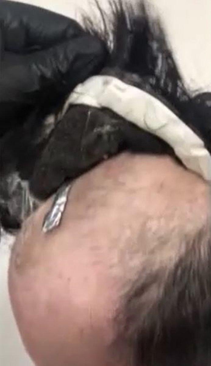 Gaziantep'te başındaki peruğun altından uyuşturucu çıktı