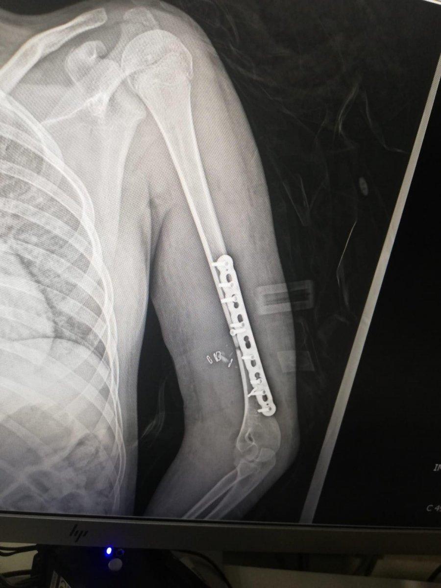 İstanbul'da 12 yaşındaki kızın pencereden atladığı anlara ait görüntüler ortaya çıktı