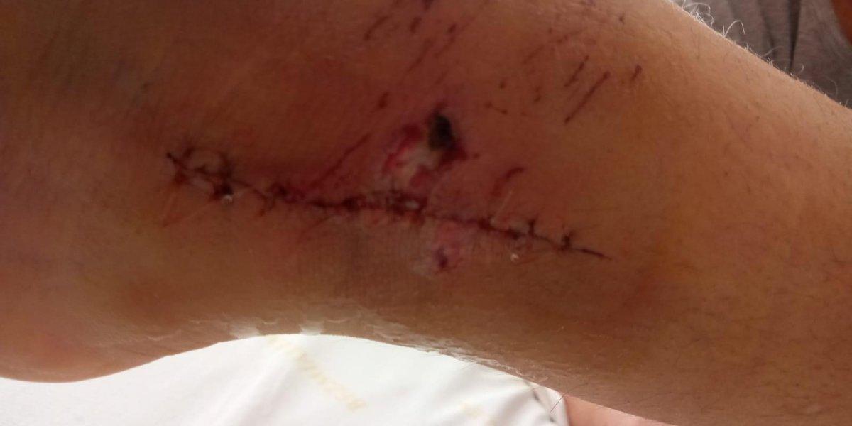 İstanbul'da 12 yaşındaki kızın pencereden atladığı anlara ait görüntüler ortaya çıktı